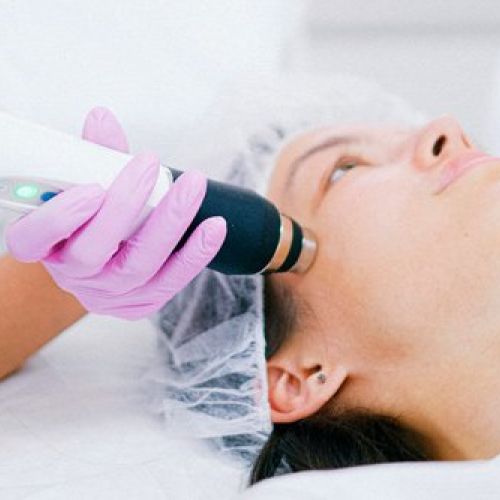 Tratamiento Indiba 30minutos